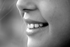銀歯が円形脱毛症の原因に！？恐怖の金属アレルギーと薄毛の関係。