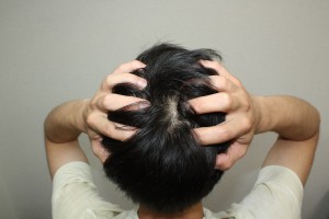 育毛の為に自分で髪を抜く！？アメリカの研究で明らかになった驚異の育毛法